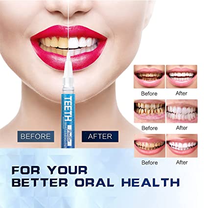 Dazzling Instant White Teeth Whitening Pen - Areebreviews