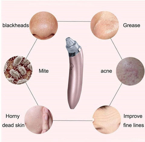 4 in 1 Blackhead Removal Machine - Areebreviews